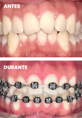 ortodoncia exitosa 09