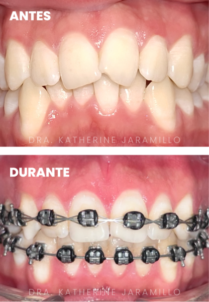 ortodoncia exitosa 09