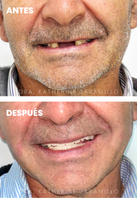 ortodoncia exitosa 10