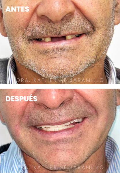 ortodoncia exitosa 10