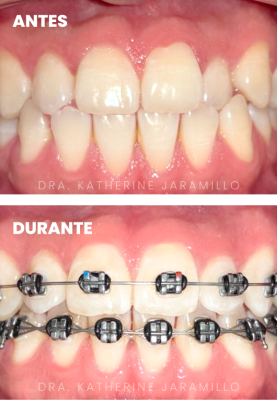ortodoncia exitosa 15