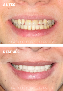 ortodoncia exitosa 16