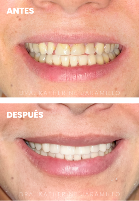 ortodoncia exitosa 16